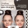 Harmonização de Orelhas (Otomodelação) de R$1.890 por apenas 1.499 em até 10X Sem Juros - Image 2